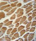 ACADL Antibody (Center)