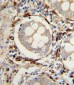 AOC3 Antibody (Center)