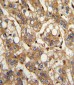 IFNB1 Antibody (N-term)