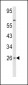 IFNB1 Antibody (N-term)