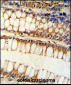 BCL2L11 Antibody (Center)