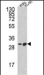 BCL2L11 Antibody (Center)