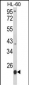 PSMB9 Antibody (C-term)