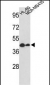 GSDMB Antibody (Center)