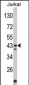 CECR5 Antibody (Center)