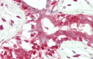 ADH5 Antibody (Center)