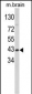 GOT1 Antibody (N-term)