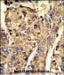 HNRPL Antibody (C-term)