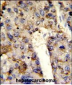 HNRPL Antibody (Center)