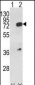 HNRPL Antibody (Center)