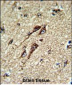 ATP5B Antibody (Center)
