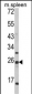 FKBP11 Antibody (C-term)