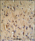 PTHLH Antibody (N-term)