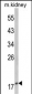 PTHLH Antibody (N-term)