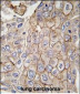 CLIC1 Antibody