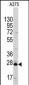 CLIC1 Antibody