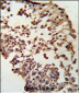 RB1 Antibody (C-term)