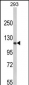 RB1 Antibody (C-term)