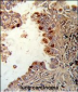 PRKCA Antibody (N-term)