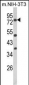 PRKCA Antibody (N-term)