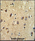 ABCC5 Antibody (Center)