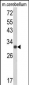 USF2 Antibody (Center)