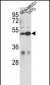 CEP55 Antibody (N-term)