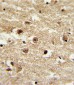 IGFBP2 Antibody (C-term)