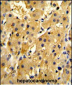 HPD Antibody (N-term)