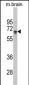 ZMYND11 Antibody (N-term)