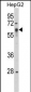 SRC Antibody (Y419)