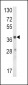 HAO1 Antibody (Center)