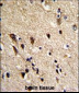 TBB1 Antibody