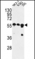 CNOT4 Antibody