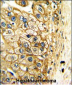 ALDH3A2 Antibody