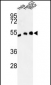 ALDH3A2 Antibody