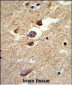 ALDH5A1 Antibody