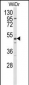 ALDH5A1 Antibody