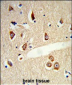 TLR3 Antibody