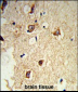 GABARAPL2  Antibody