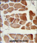 RUVBL1 Antibody