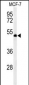 RUVBL1 Antibody