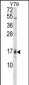 GADD45A Antibody (C-term)