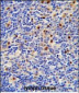 LTA4H Antibody (Center)