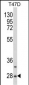 SNRPB Antibody (N-term R49)