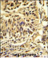 CEBPB Antibody (C-term)