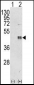 CEBPB Antibody (C-term)