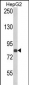 ECE1 Antibody (Center)