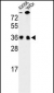SFRS1 Antibody (N-term)