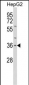 IL1A Antibody (Center)